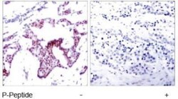 RelA/NFkB p65, p Ser276 Antibody, Novus Biologicals:Antibodies:Primary